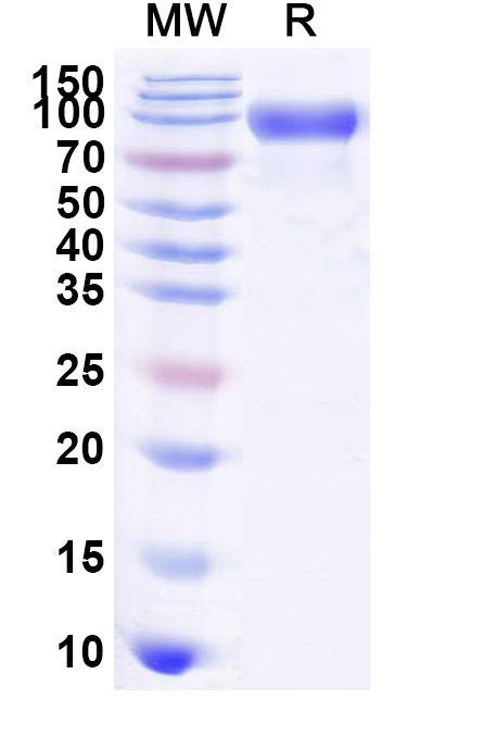 SDS-PAGE for Human CD358/TNFRSF21 Recombinant Protein, C-Fc