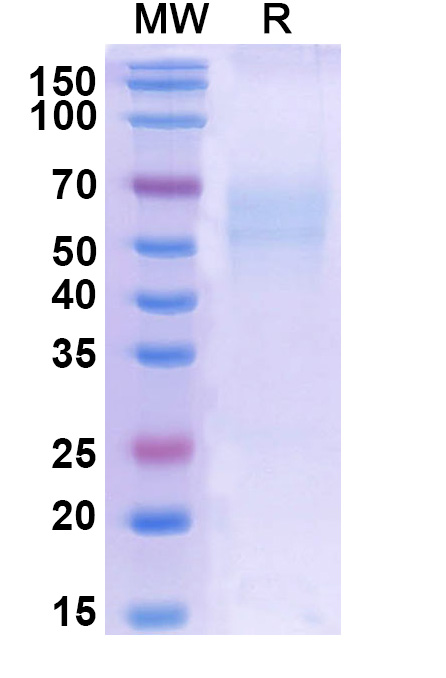 SDS-PAGE for Human CD358-TNFRSF21 recombinant protein
