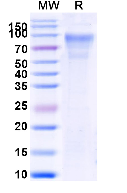 SDS-PAGE for Human CD45/PTPRC Recombinant Protein, C-His