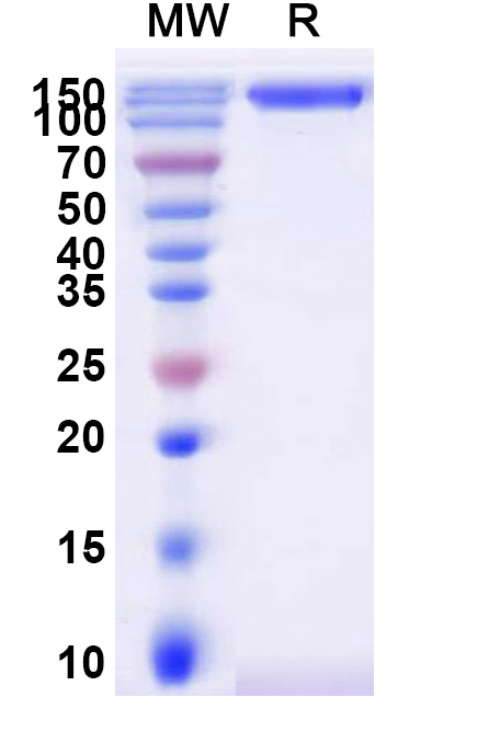 SDS-PAGE for Human CD66e/CEACAM5 Recombinant Protein, C-Fc