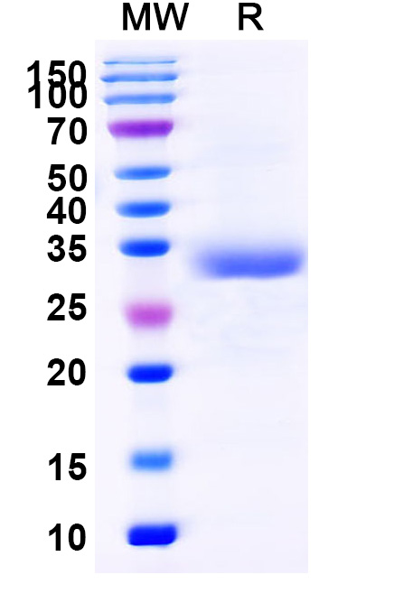 SDS-PAGE for Human CD7 recombinant protein