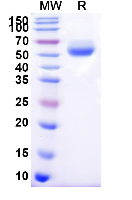 SDS-PAGE for Human CD95/FAS Recombinant Protein, C-Fc