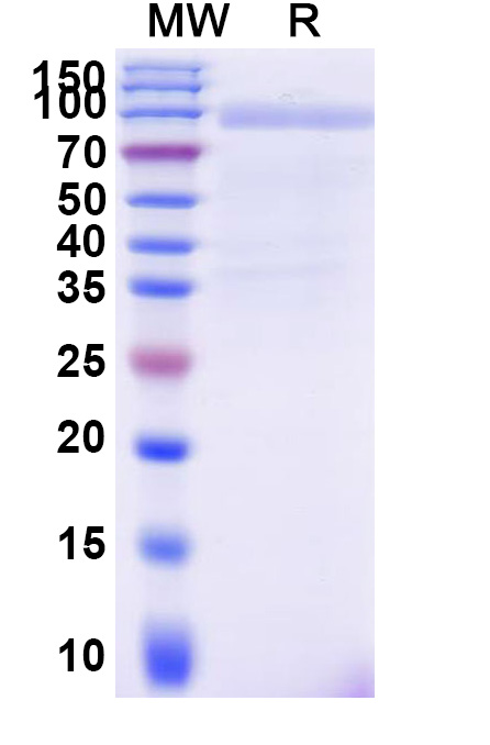 SDS-PAGE for Human CD97/ADGRE5 Recombinant Protein, C-Fc