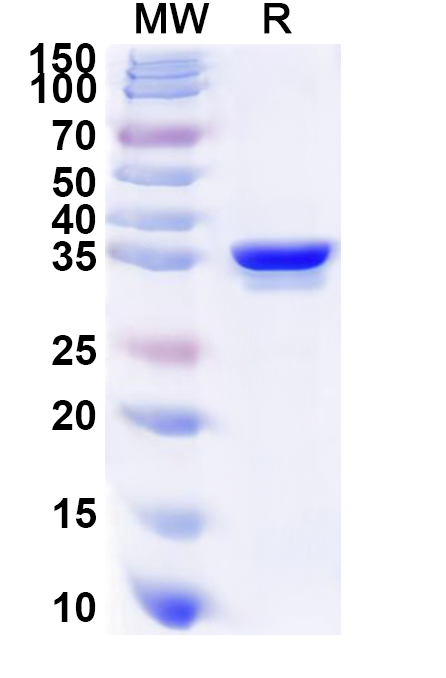 SDS-PAGE for Human CDK11B Recombinant Protein, N-His