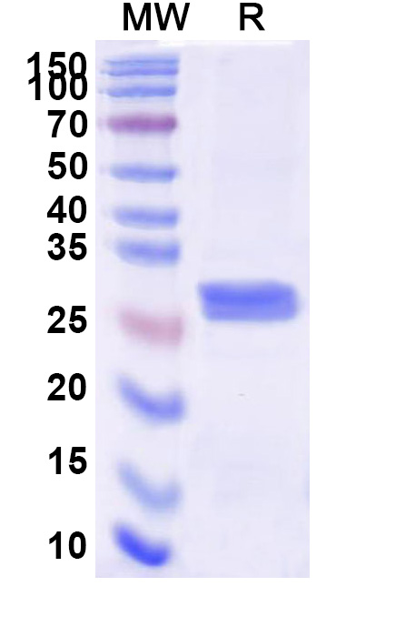 SDS-PAGE for Human CFD recombinant protein