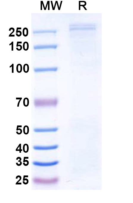 SDS-PAGE for Human CHD4 Recombinant Protein, C-His