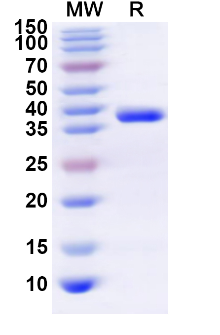 SDS-PAGE for Human CX3CR1 Recombinant Protein, N-GST & C-His