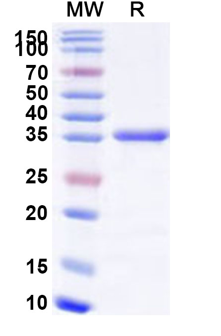 SDS-PAGE for Human DDB1 Recombinant Protein, N-His