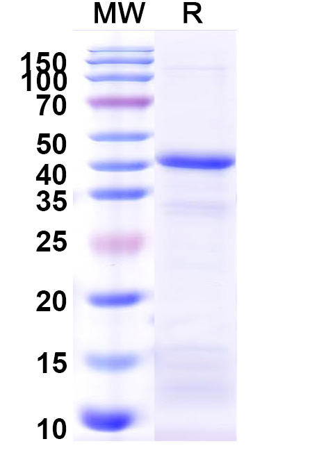 SDS-PAGE for Human DKK3 recombinant protein