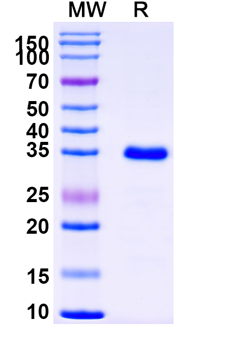 SDS-PAGE for Human DNMT3A recombinant protein