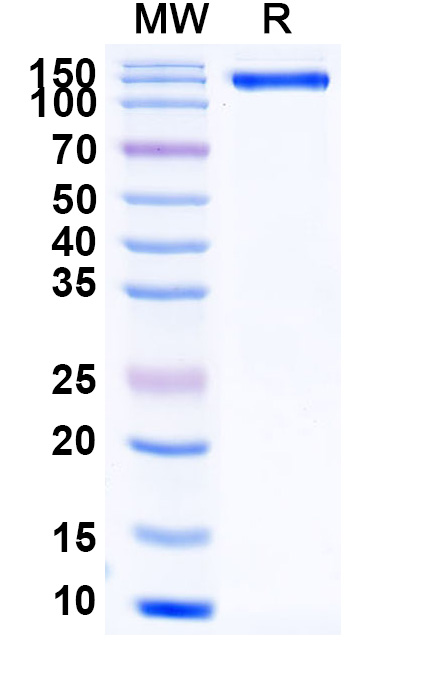 SDS-PAGE for Human ERBB4 recombinant protein