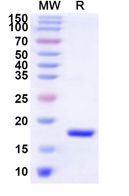 SDS-PAGE for Human FRG1 Recombinant Protein, N-His