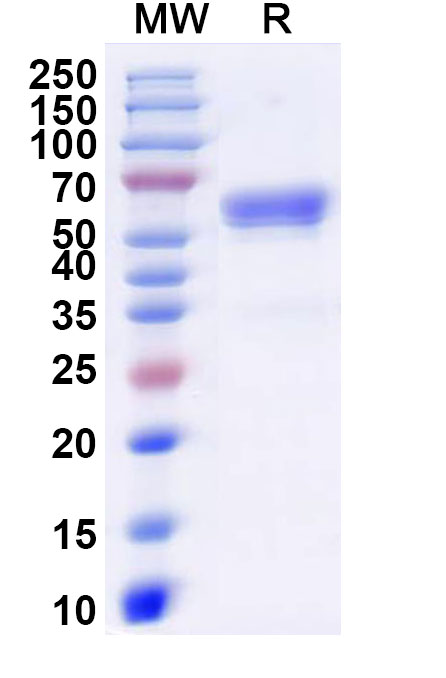 SDS-PAGE for Human FZD7 recombinant protein