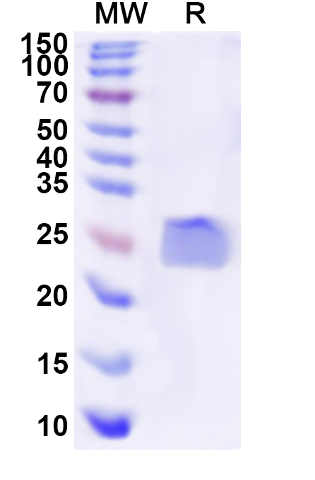 SDS-PAGE for Human GPX2 Recombinant Protein, N-His