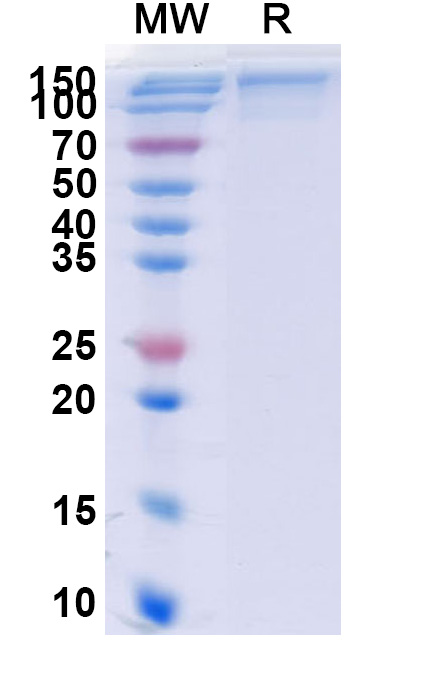 SDS-PAGE for Human IL13RA2 recombinant protein
