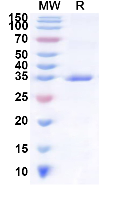 SDS-PAGE for Human IL23R Recombinant Protein, N-His