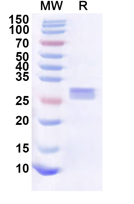 SDS-PAGE for Human MCOLN2 Recombinant Protein, N-His