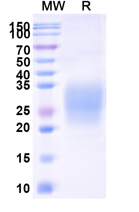 SDS-PAGE for Human NKG2D-CD314 recombinant protein, C-His Tag