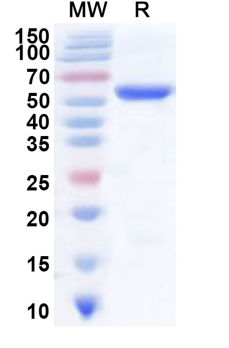 SDS-PAGE for Human P4HB Recombinant Protein, N-His