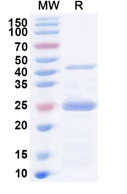 SDS-PAGE for Human PDCD6IP Recombinant Protein, N-His