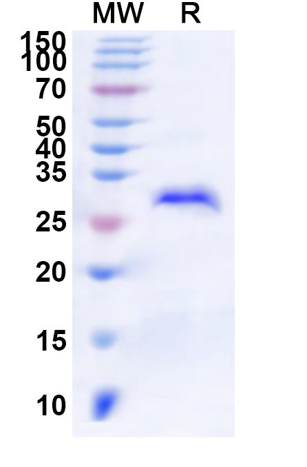 SDS-PAGE for Human PLAG1 Recombinant Protein, N-His
