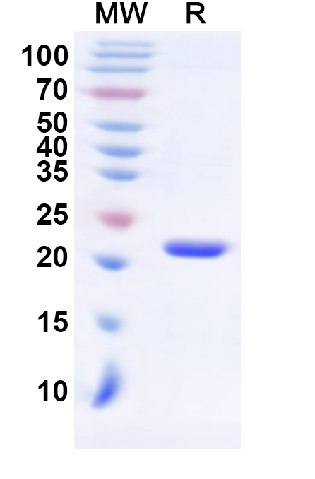 SDS-PAGE for Human RPL9 Recombinant Protein, N-His