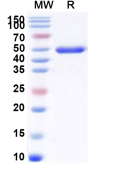 SDS-PAGE for Human SETD7 Recombinant Protein, N-His