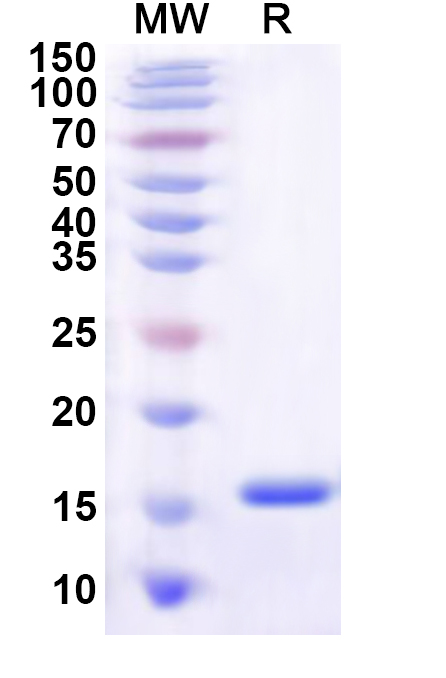 SDS-PAGE for Human SLC4A4 Recombinant Protein, C-His
