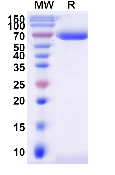 SDS-PAGE for Human ST6GAL1 recombinant protein