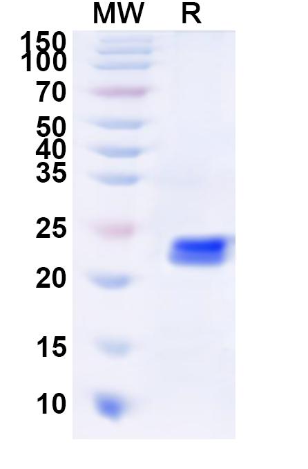 SDS-PAGE for Human THOC7 Recombinant Protein, N-His