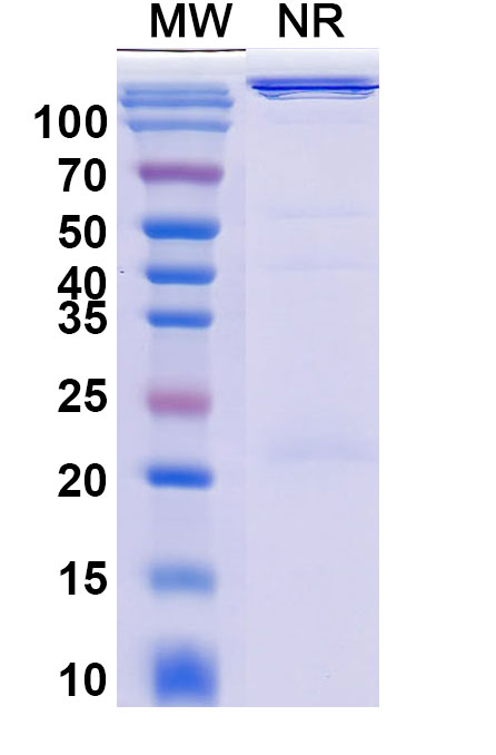 SDS-PAGE for Human TRAC Monoclonal Antibody