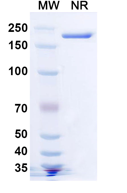 SDS-PAGE for Human TREM2 Monoclonal Antibody