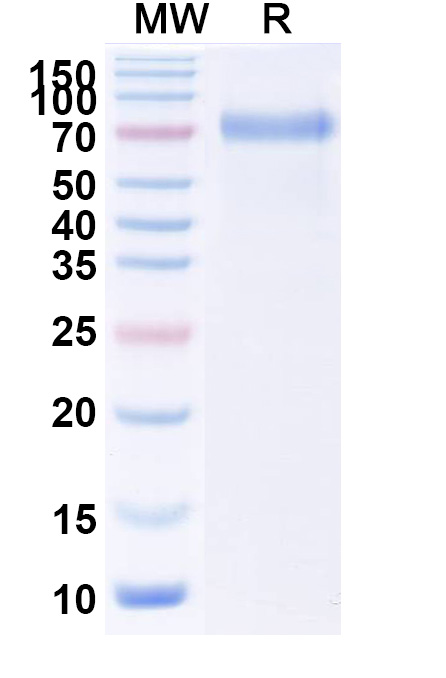 SDS-PAGE for Human TSHR recombinant protein