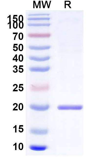SDS-PAGE for IL11, N-His, recombinant protein