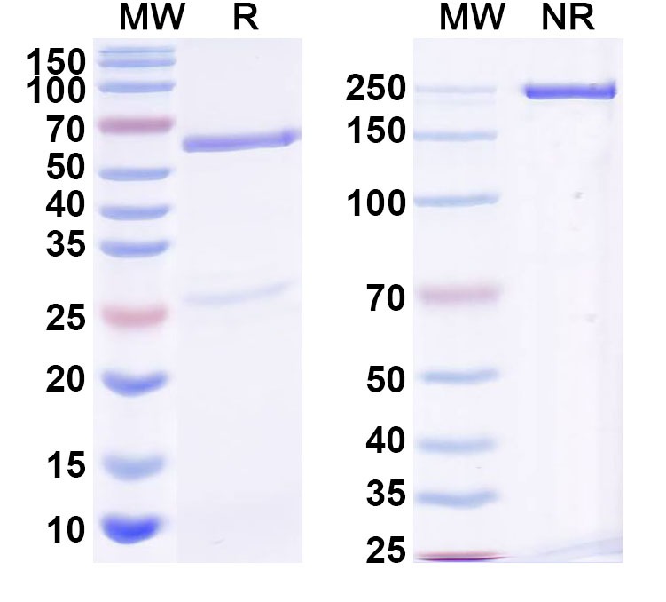 SDS-PAGE for InVivoMAb Anti-HIV1 env/Env polyprotein (Iv0039)