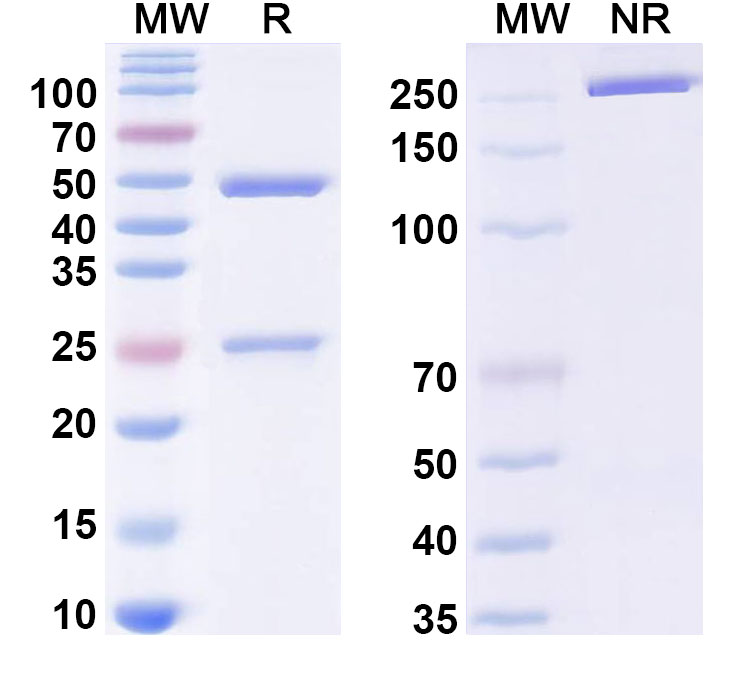 SDS-PAGE for InVivoMAb Anti-HPV B19/B19V VP1/Coat protein VP1 (Iv0008)