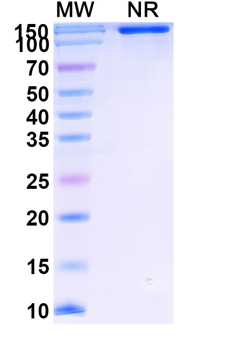 SDS-PAGE for Research Grade Ipafricept