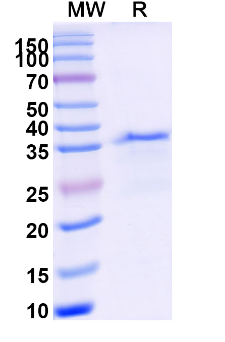 SDS-PAGE for ITGAL recombinant protein