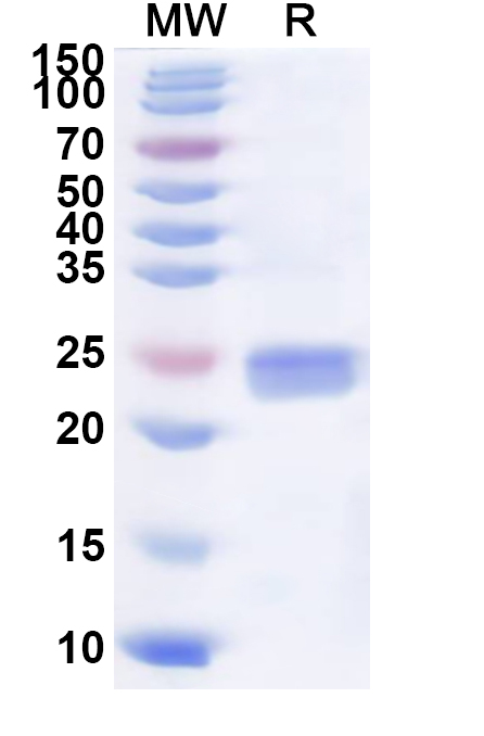 SDS-PAGE for JUNV Glycoprotein GP1, N-His