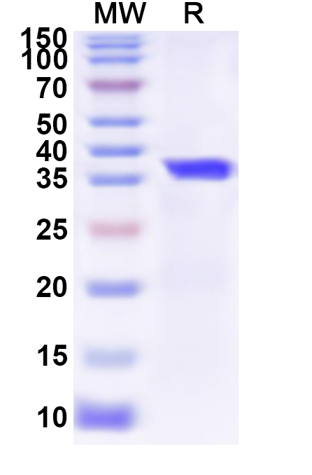 SDS-PAGE for JUNV Recombinant Protein Z, N-His