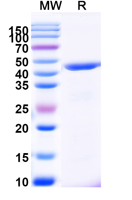 SDS-PAGE for Keratin, type I cytoskeletal 19(KRT19)