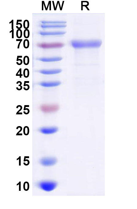 SDS-PAGE for Mojiang virus MojV G recombinant protein