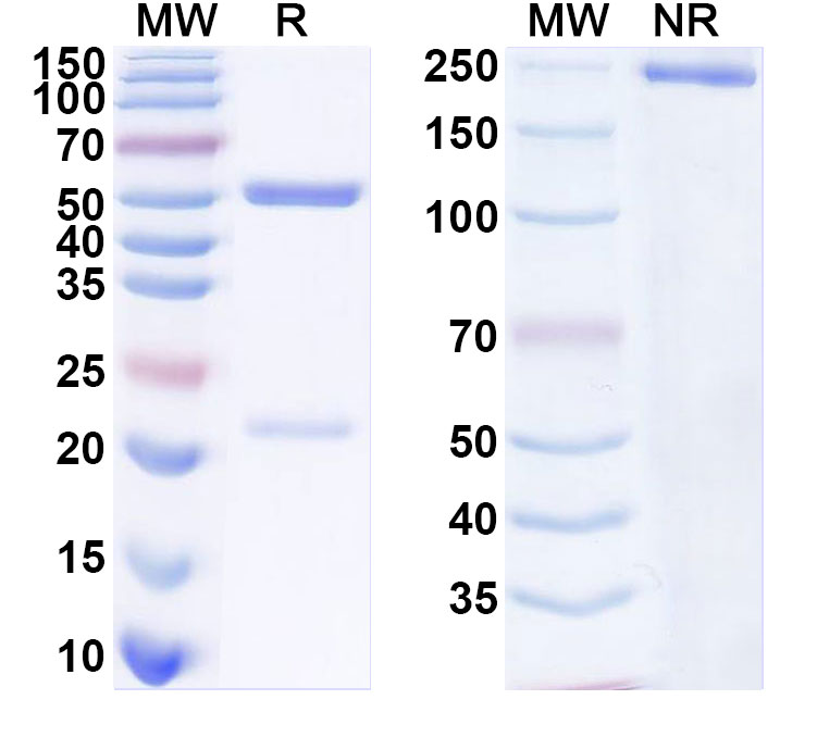 SDS-PAGE for Mouse Anti-DNA Recombinant Autoantibody (PME77)