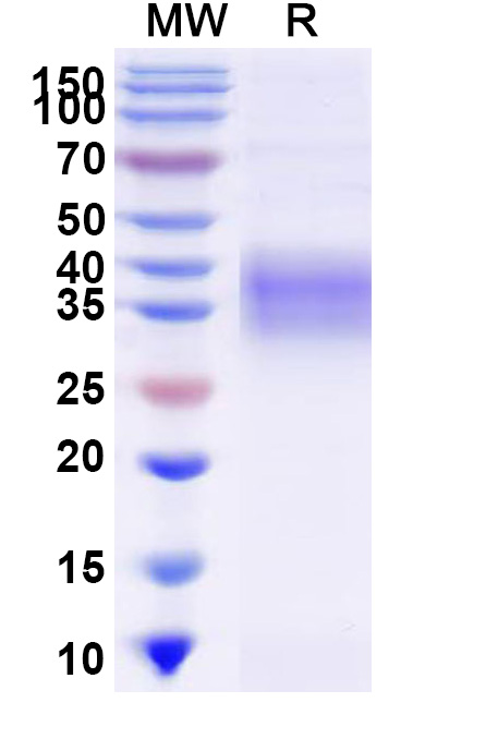 SDS-PAGE for Mouse CD120a/TNFRSF1A Recombinant Protein, C-His