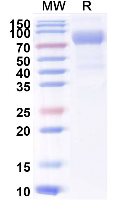 SDS-PAGE for Mouse CD122/IL2RB Recombinant Protein, C-Fc