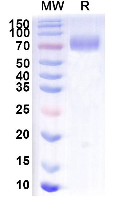 SDS-PAGE for Mouse CD6 Recombinant Protein, C-Fc