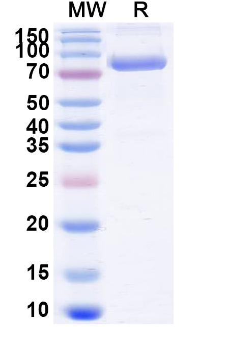 SDS-PAGE for Mouse CD71/TFRC Recombinant Protein, C-His