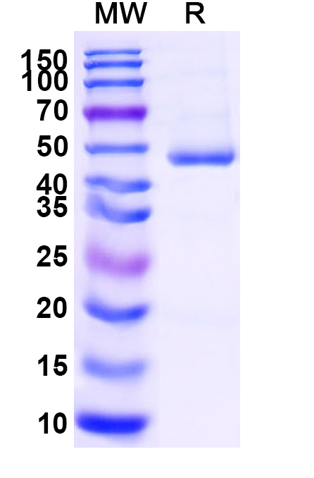 SDS-PAGE for Mouse CDw293/BMPR1B Recombinant Protein, C-Fc