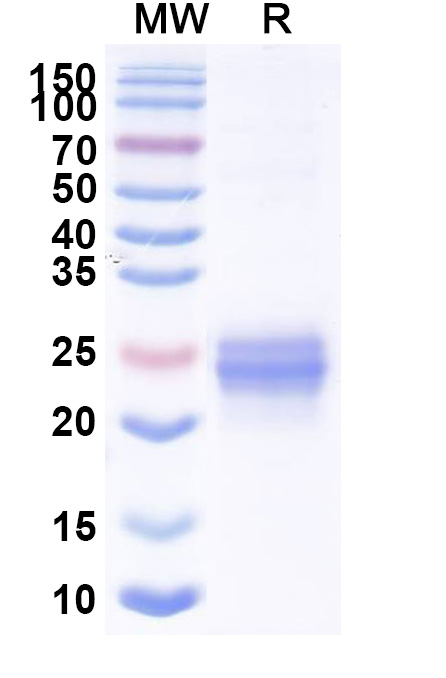 SDS-PAGE for Mouse EFNA1 Recombinant Protein, C-His