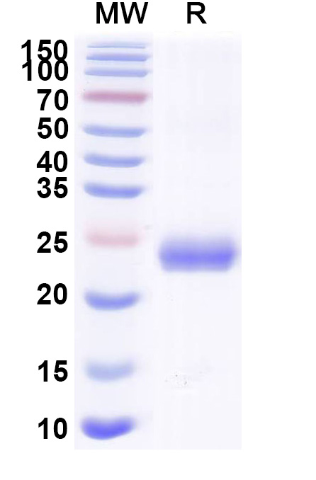 SDS-PAGE for Mouse EFNA4 Recombinant Protein, C-His